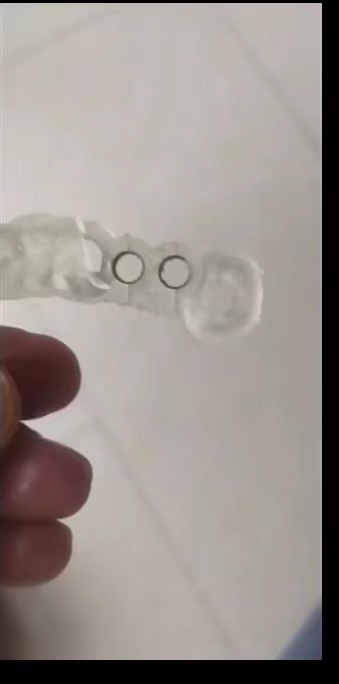 レジンデンタルプリンター,植栽ガイド,高精度の硬さ,uv次元 - Glue For 3D Printing のレビューと価格